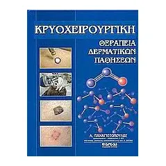 Κρυοχειρουργική θεραπεία δερματικών παθήσεων