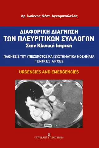 Διαφορική διάγνωση των πλευριτικών συλλογών στην κλινική ιατρική